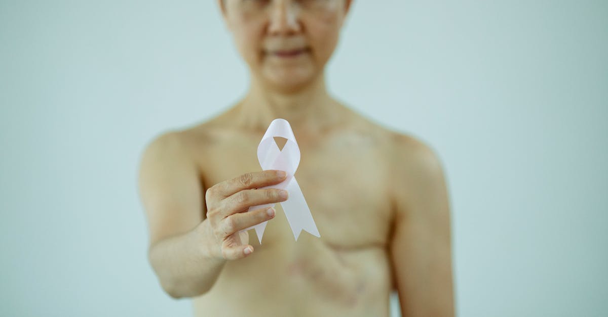 Por que a mamografia revela tanto tecido glandular?